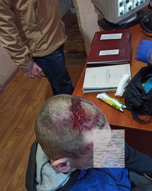 Російський обстріл Біленьківської колонії: правозахисники питають, хто в уряді відповідальний за безпеку в’язнів